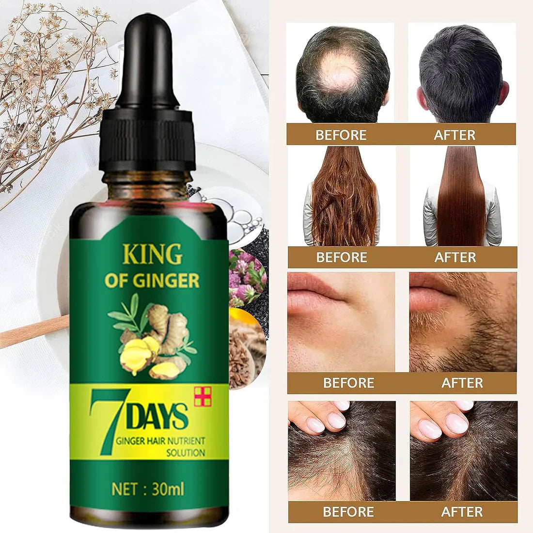 🚨GRAN LANZAMIENTO⚡️ - SERUM JENGIBRE ANTI CAIDA Y CRECIMIENTO ACELERADO 7DAYS™